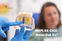 IMPLAN GIGI, AMAN GAK YA?