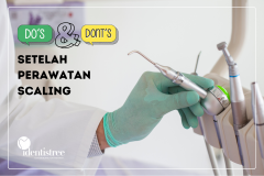 DOâ€™S & DONâ€™TS SETELAH PERAWATAN SCALING