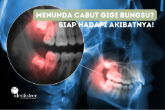MENUNDA CABUT GIGI BUNGSU? SIAP HADAPI AKIBATNYA