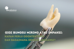 Gigi Bungsu Miring atau Impaksi: Kapan Perlu Odontektomi dan Bagaimana dengan Asuransi?