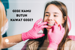 APAKAH KAMU PERLU KAWAT GIGI?