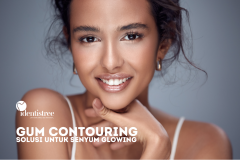 GUM CONTOURING, SOLUSI UNTUK SENYUM GLOWING