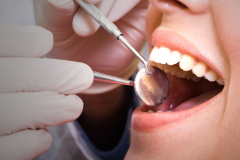 MASALAH GERAHAM BUNGSU YANG PERLU ANDA KETAHUI