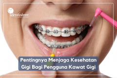 PENTINGNYA MENJAGA KESEHATAN GIGI BAGI PEMAKAI KAWAT GIGI