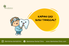 KAPAN GIGI ANAK MULAI TANGGAL?