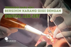 BERSIHIN KARANG GIGI PAKAI DENTAL AIR JET, TEKNOLOGI BARU NIH!