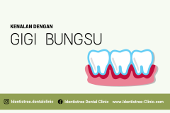 KENALAN DENGAN SI GIGI BUNGSU