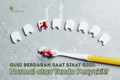 Gusi Berdarah Saat Sikat Gigi: Normal atau Tanda Penyakit?