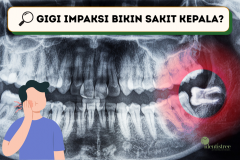 SAKIT KEPALA MENAHUN! TERNYATA KARENA GIGI IMPAKSI, KOK BISA YA?
